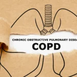 Chronic Obstructive Pulmonary Disease