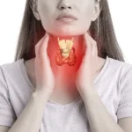 Hyperthyroidism Decoded: Exploring Causes, Symptoms, and Treatment Options