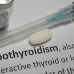 Hypothyroidism: Understanding Causes, Symptoms, and Management