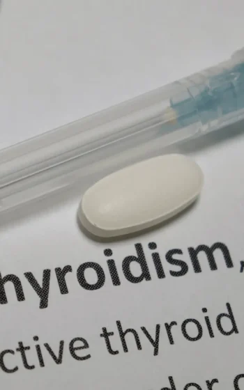 Hypothyroidism: Understanding Causes, Symptoms, and Management